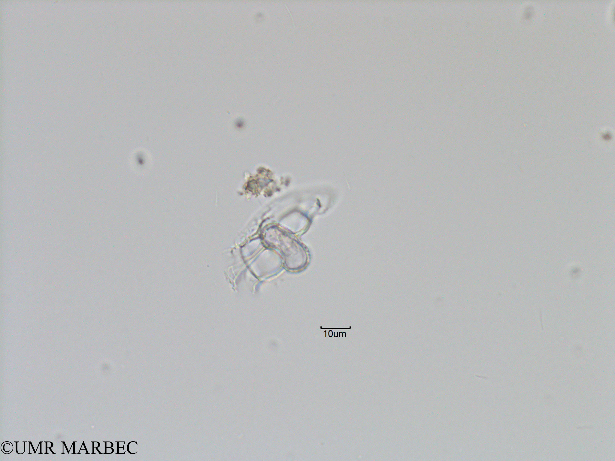 phyto/Bizerte/bizerte_bay/RISCO November 2015/Histioneis sp1 (Baie_T5-C2-Histioneis-8).tif(copy).jpg